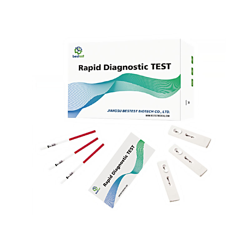 CMV IgM/IgG TEST